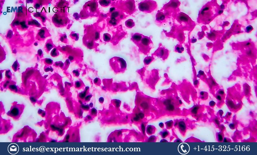 Renal Cell Carcinoma