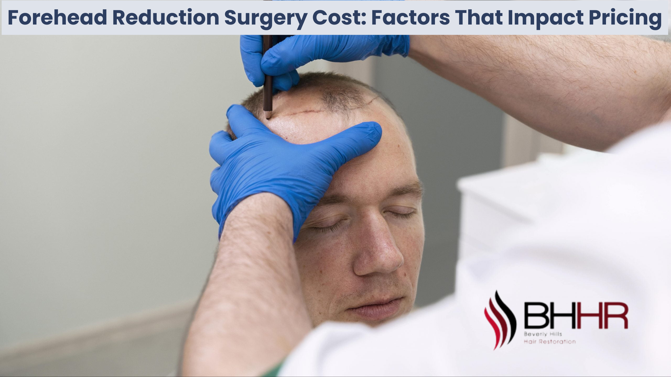 cost of forehead reduction surgery